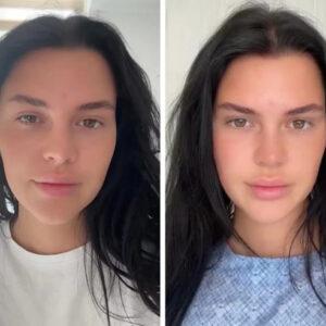 Nelly's appearance before eye surgery